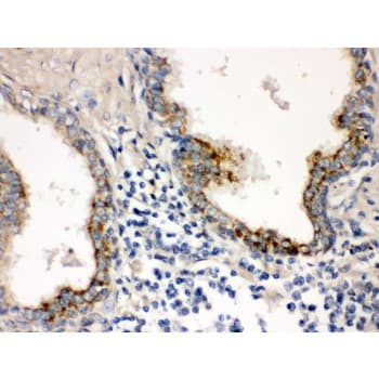 PTP4A2 / PRL-2 Antibody (aa40-69)