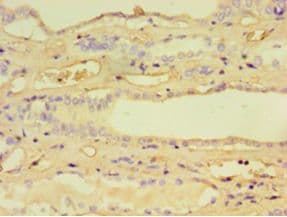 CCBL1 Antibody (aa1-372)