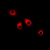 SPINLW1 / EPPIN Antibody