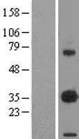 EBAG9 / RCAS1 Protein (Over-Expression Lysate Myc-DDK (Flag))