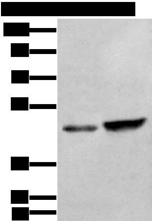 ZNF191 / ZNF24 Antibody