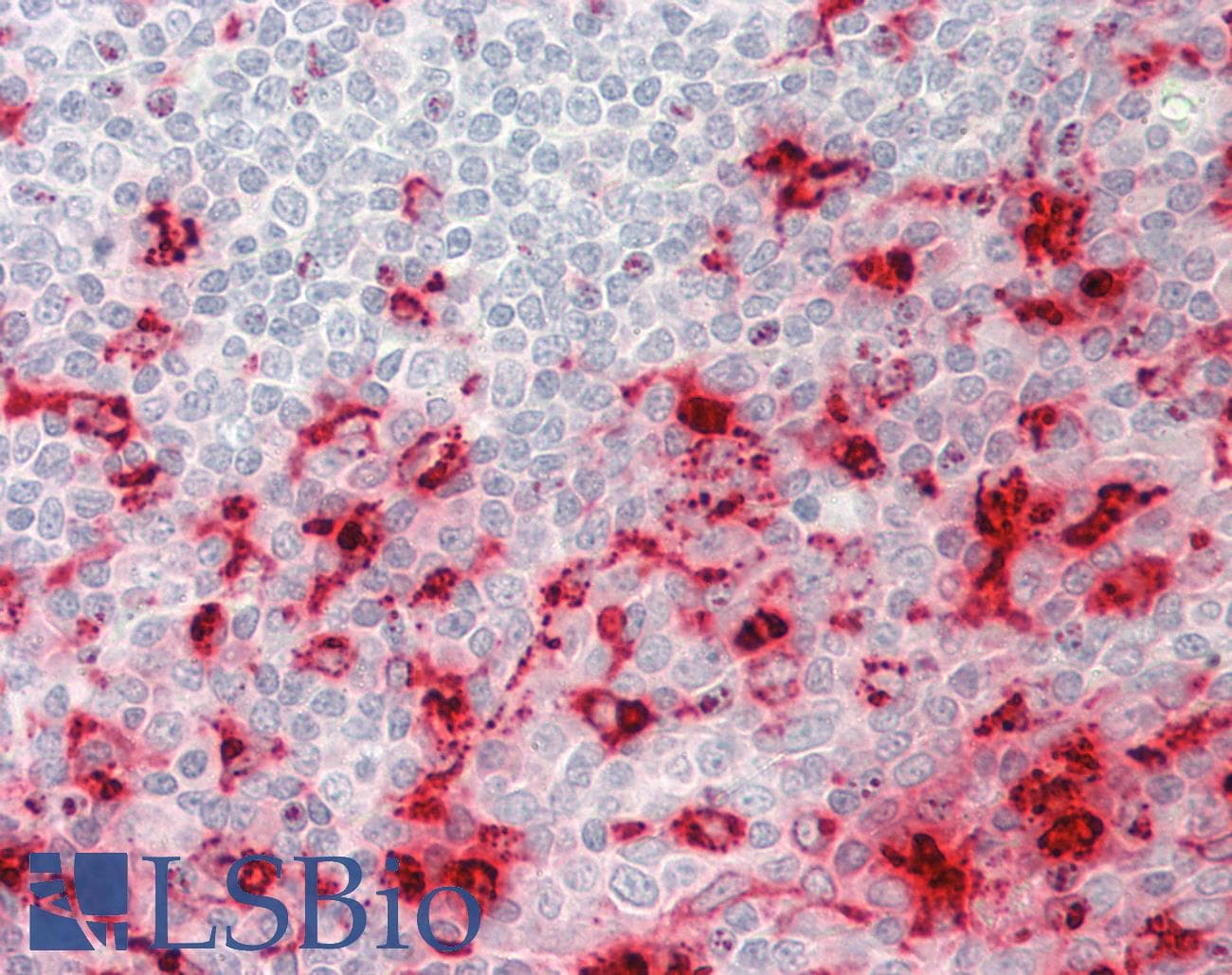 IHC-plus™ LYZ / Lysozyme Antibody