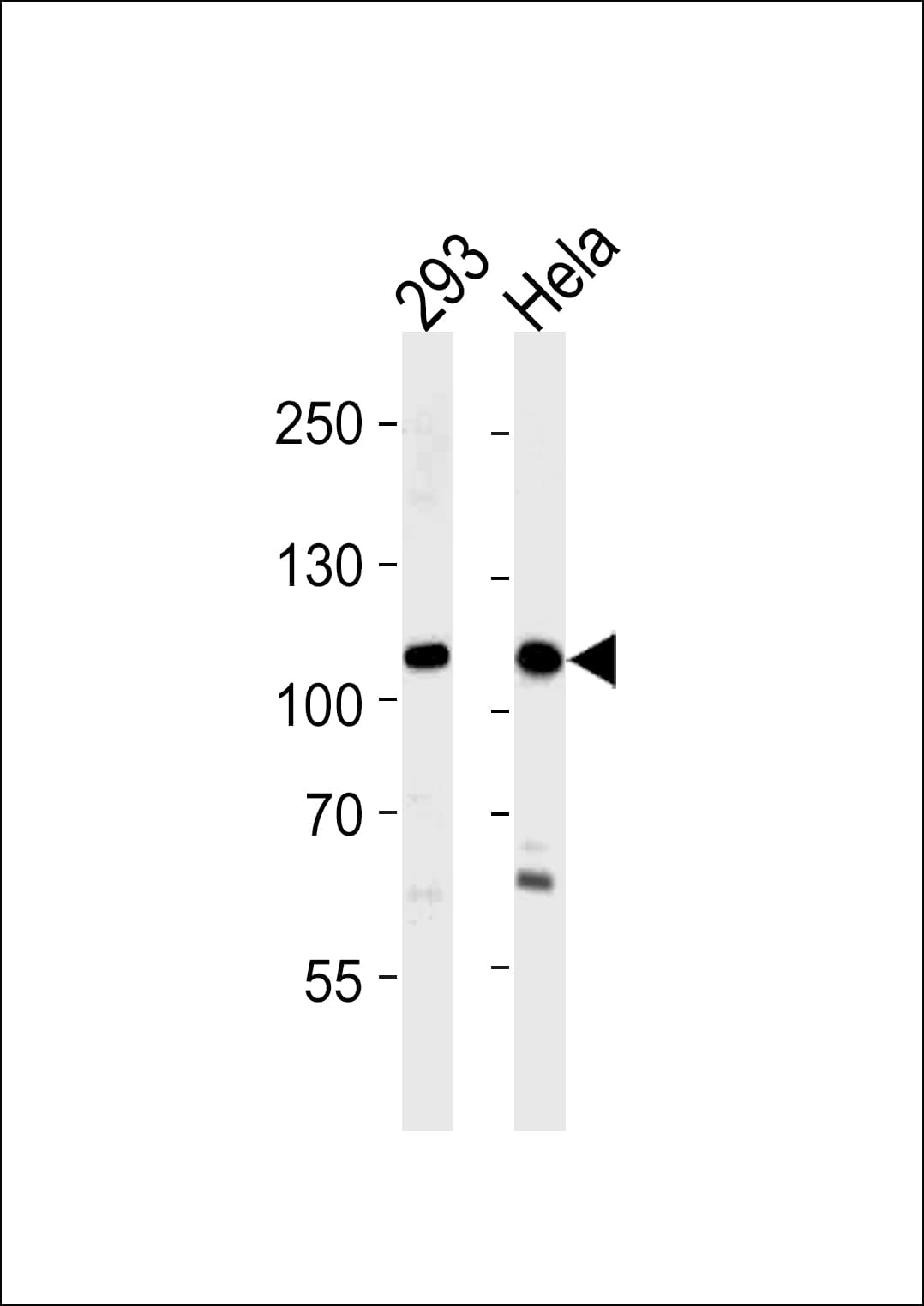 SALL4 Antibody (aa1009-1039)