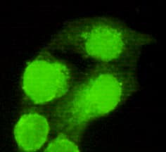 AMACR / P504S Antibody (C-Terminus)