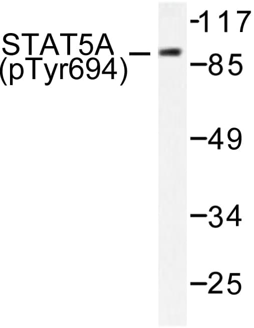 Polyclonal Rabbit anti-Human STAT5 A+B Antibody (phospho-Tyr694, IHC, WB)