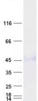 Human WNT5A Protein (Recombinant Myc-DDK (Flag))