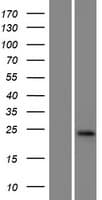 GGTLA4 / GGTLC1 Protein (Over-Expression Lysate Myc-DDK (Flag))