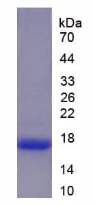 Human LF / LTF / Lactoferrin Protein (Recombinant His)