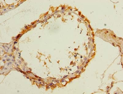 Polyclonal Rabbit anti-Human SLC25A33 Antibody (IHC)