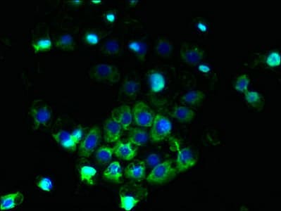Polyclonal Rabbit anti-Human ABCB5 Antibody (IHC)