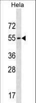 GALR3 / Galanin Receptor 3 Antibody (aa279-307)