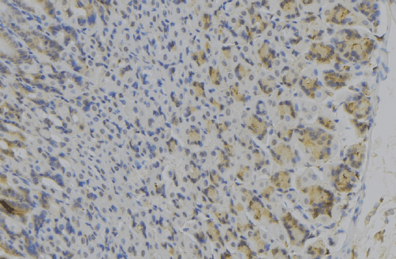 Polyclonal Rabbit anti-Human IDH1 / IDH Antibody (IHC, WB)
