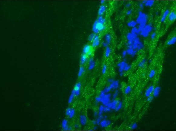 PathPlus™ NCAM / CD56 Antibody (clone 123C3)