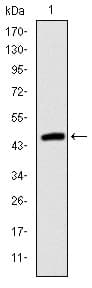 Monoclonal Mouse anti-Human TNNI2 Antibody (clone 2F12A11, IHC, WB)