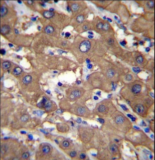 Polyclonal Rabbit anti-Human UGDH / UDPGDH Antibody (aa465-494, IHC, WB)