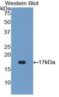 Polyclonal Rabbit anti-Human FGF23 Antibody (aa157-238, WB)