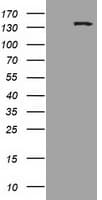 HDAC6 Antibody (clone OTI3E7)