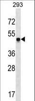 SNX17 Antibody (aa53-82)