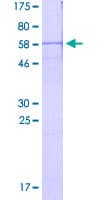 Human TJP1 / ZO-1 Protein (Recombinant GST, N-terminus)