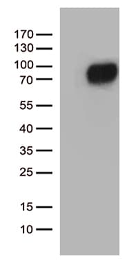 CSF2RA / CD116 Antibody (aa23-320, clone OTI2D6, Carrier-free)