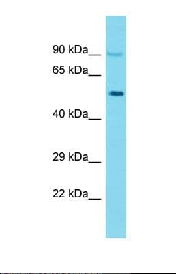 KRT26 / Keratin 26 Antibody (aa384-433)