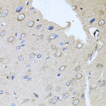Polyclonal Rabbit anti-Human RARA / RAR Alpha Antibody (IHC, WB)