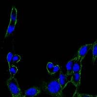 Monoclonal Mouse anti-Human FAK / Focal Adhesion Kinase Antibody (clone 10H7, IHC, IF, WB)