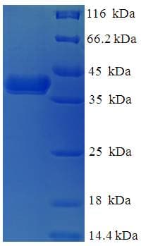 Human DNAJB8 Protein (Recombinant His-SUMO)