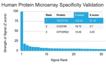 TROP2 / TACSTD2 Antibody (clone TACSTD2/2153)