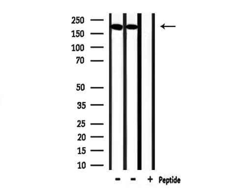 Endostatin Antibody