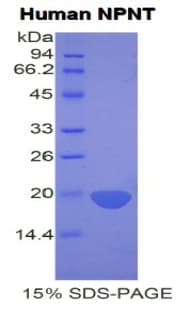 Human NPNT / Nephronectin Protein (Recombinant His)
