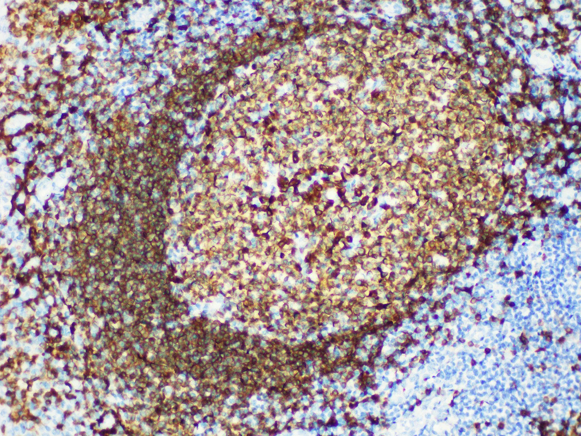 CD79A / CD79 Alpha Antibody