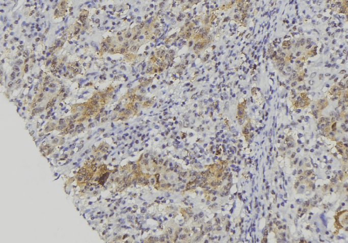 CMA1 / Mast Cell Chymase Antibody