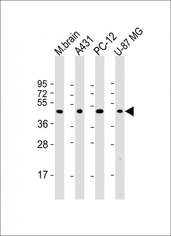 THRA / THR Alpha Antibody (aa107-139)