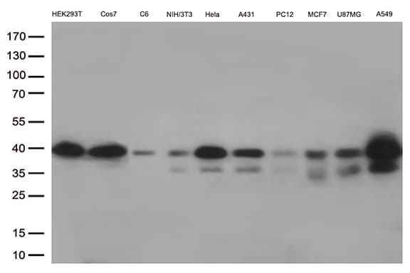 PRKAB1 / AMPK Beta 1 Antibody (aa2-270, clone OTI8D5, Carrier-free)
