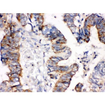 IGFBP3 Antibody (aa214-252)