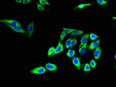 Polyclonal Rabbit anti-Human Claudin 20 / CLDN20 Antibody (WB)