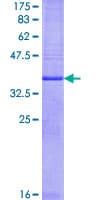 Human PGES / PTGES Protein (Recombinant GST)