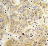 VARS / ValRS Antibody (aa251-279)