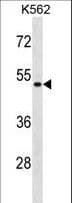 Polyclonal Rabbit anti-Human ENOSF1 Antibody (aa63-92, WB)