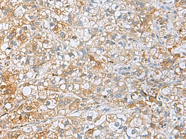 UCHL1 / PGP9.5 Antibody