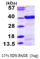 Human NMI Protein (Recombinant His)