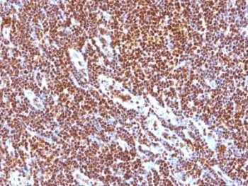 SUMO1 / SMT3 Antibody (clone SUMO1/1188, Ready-to-Use)