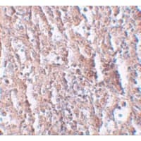 SLC39A5 / ZIP5 Antibody
