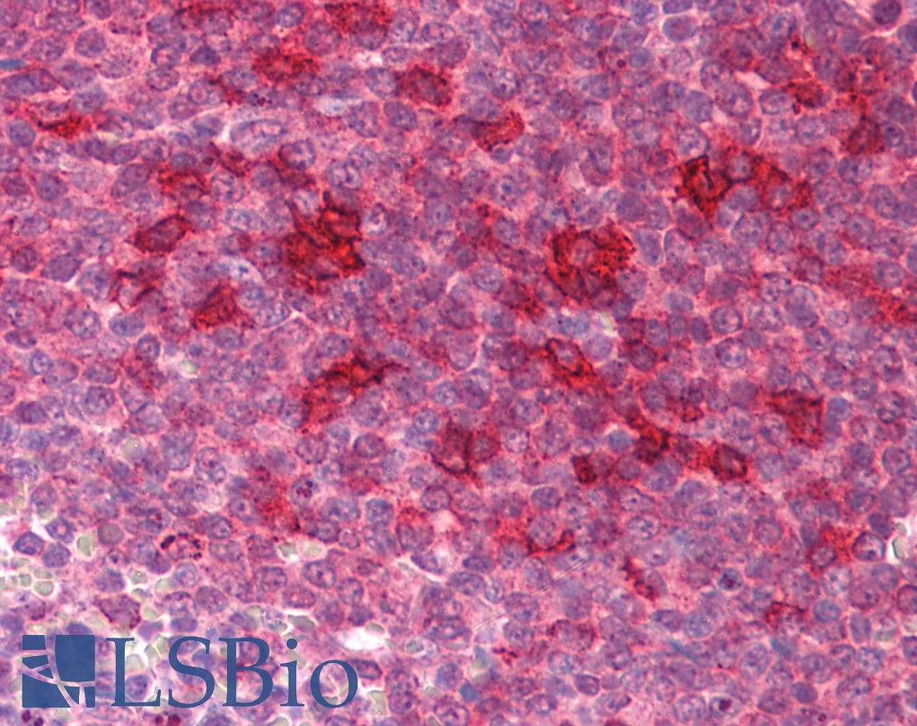 IHC-plus™ Polyclonal Chicken anti-Human KLHL25 Antibody (IHC, IF, WB)