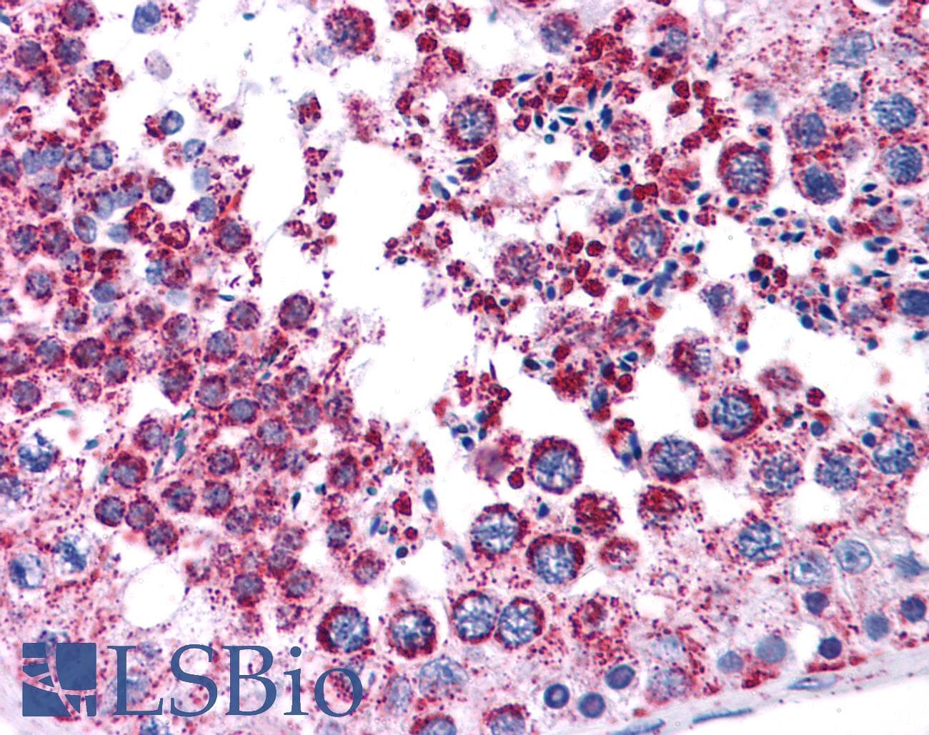 MAGEA3 Antibody (aa216-265, FITC)