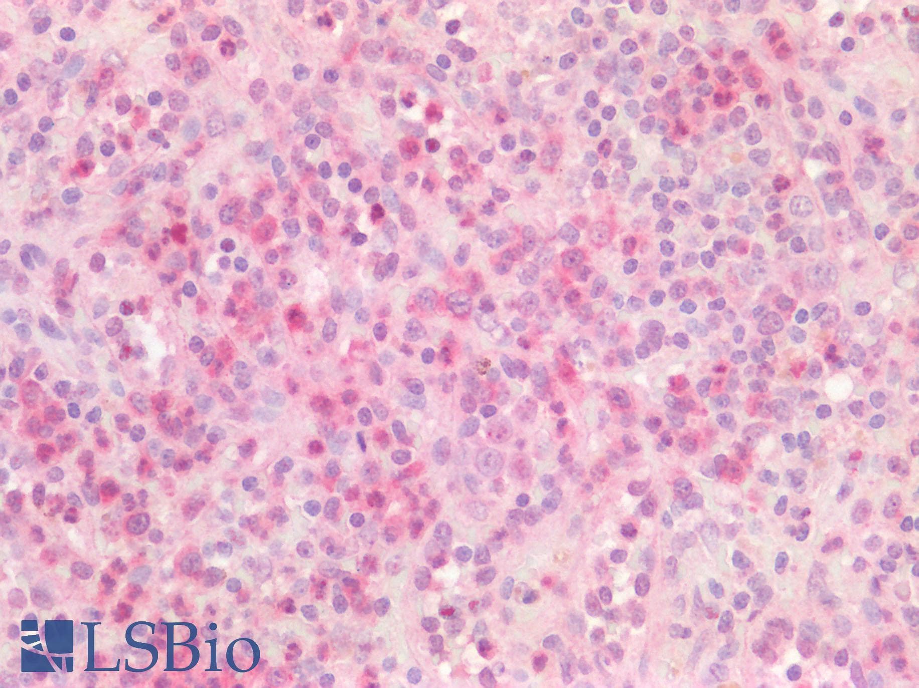 IHC-plus™ p16INK4a / CDKN2A Antibody
