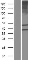 ALDH3B1 Protein (Over-Expression Lysate Myc-DDK (Flag))