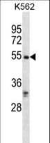 Polyclonal Rabbit anti-Human RIPK3 / RIP3 Antibody (aa480-509, IHC, WB)