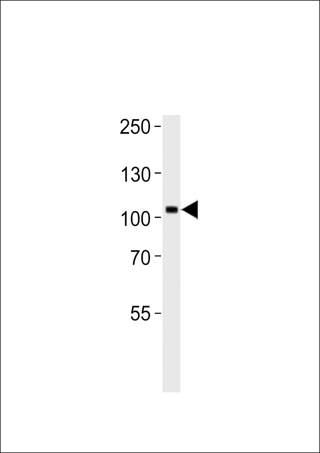 NTRK3 / TRKC Antibody